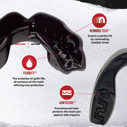 Protector Bucal Serie de introducción de SafeJawz